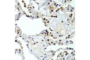 Immunohistochemistry of paraffin-embedded human normal lung using GTF2F1 antibody. (GTF2F1 antibody)