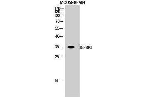 Western Blotting (WB) image for anti-Insulin-Like Growth Factor Binding Protein 3 (IGFBP3) (Ser53) antibody (ABIN3180119) (IGFBP3 antibody  (Ser53))