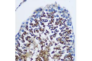 Immunohistochemistry of paraffin-embedded Rat testis using ST Rabbit pAb (ABIN1682908, ABIN1682909, ABIN5664112 and ABIN6219730) at dilution of 1:100 (40x lens). (STAT4 antibody  (AA 600-700))