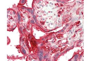 Human Placenta: Formalin-Fixed, Paraffin-Embedded (FFPE) (DAB2 antibody  (AA 743-770))