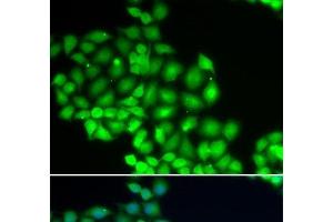 Immunofluorescence analysis of HeLa cells using ERCC2 Polyclonal Antibody (ERCC2 antibody)