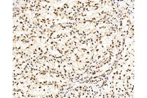 IHC analysis of DBC-1/CCAR2 using anti-DBC-1/CCAR2 antibody (ABIN7602235). (CCAR2 antibody  (AA 65-917))