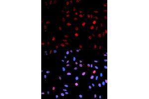 Immunofluorescence (IF) image for anti-Tumor Protein P53 (TP53) (pSer15) antibody (ABIN1870674) (p53 antibody  (pSer15))