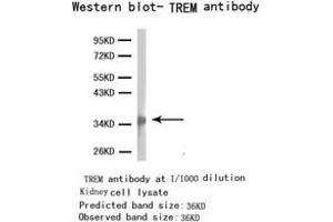Western Blotting (WB) image for anti-Triggering Receptor Expressed On Myeloid Cells 1 (TREM1) antibody (ABIN1875201) (TREM1 antibody)