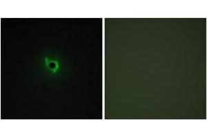 Immunofluorescence analysis of COS7 cells, using EPHA6 Antibody. (EPH Receptor A6 antibody  (AA 891-940))