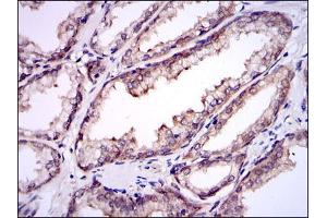 Immunohistochemistry (IHC) image for anti-Ubiquitin-Conjugating Enzyme E2I (UBE2I) antibody (ABIN969451)