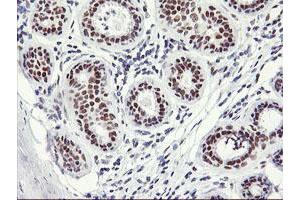 Immunohistochemical staining of paraffin-embedded Human breast tissue using anti-OBFC2B mouse monoclonal antibody. (SSBP1 antibody)