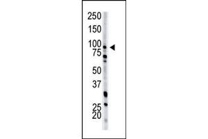 Image no. 1 for anti-phosphofructokinase, Muscle (PFKM) (N-Term) antibody (ABIN360632) (PFKM antibody  (N-Term))