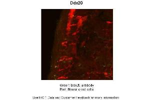 Sample Type :  Mouse Gut Tissue TgWnt1-Cre/+ Ednrbflex3/+ Rosa26YFPStop/YFPStop  Primary Antibody Dilution :  1:50  Secondary Antibody :  Goat anti-rabbit-cy3  Secondary Antibody Dilution :  1:1500  Color/Signal Descriptions :  Ddx20: Green Neural crest cells:: Red  Gene Name :  Ddx20  Submitted by :  Anonymous (DDX20 antibody  (N-Term))