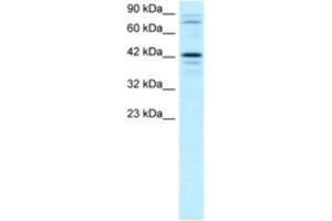Western Blotting (WB) image for anti-SRY (Sex Determining Region Y)-Box 18 (SOX18) antibody (ABIN2460643)