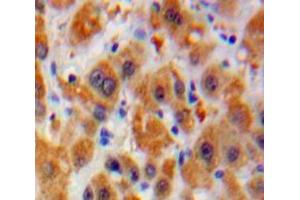 Used in DAB staining on fromalin fixed paraffin-embedded Liver tissue (Laminin alpha 5 antibody  (AA 3517-3718))