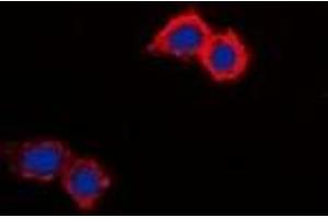 Immunofluorescent analysis of NHE8 staining in HepG2 cells. (NHE8 antibody  (C-Term))