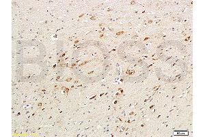 Formalin-fixed and paraffin embedded rat brain labeled with Anti-ChAT Polyclonal Antibody, Unconjugated (ABIN724070) 1:200followed by conjugation to the secondary antibody and DAB staining (Choline Acetyltransferase antibody  (AA 101-200))