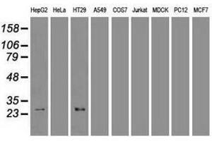 Image no. 1 for anti-Hematopoietically Expressed Homeobox (HHEX) (AA 100-270) antibody (ABIN1490800)