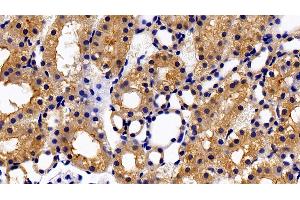 Detection of PRLR in Rat Kidney Tissue using Polyclonal Antibody to Prolactin Receptor (PRLR) (Prolactin Receptor antibody  (AA 20-229))