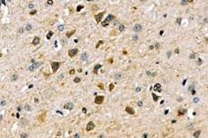 Immunohistochemistry analysis of paraffin-embedded mouse brain using,SLC6A15 (ABIN7075681) at dilution of 1: 600 (SLC6A15 antibody)