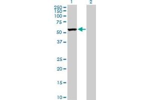 Western Blot analysis of CAP1 expression in transfected 293T cell line by CAP1 MaxPab polyclonal antibody. (CAP1 antibody  (AA 1-475))