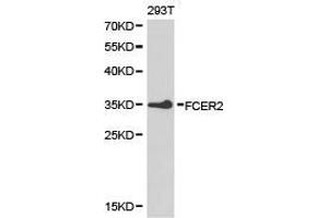 Western Blotting (WB) image for anti-Fc Fragment of IgE, Low Affinity II, Receptor For (CD23) (FCER2) antibody (ABIN1872669) (FCER2 antibody)
