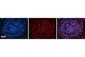 Rabbit Anti-TSPAN3 Antibody   Formalin Fixed Paraffin Embedded Tissue: Human Testis Tissue Observed Staining: Plasma membrane in spermatogonia and spermatocytes Primary Antibody Concentration: N/A Other Working Concentrations: 1:600 Secondary Antibody: Donkey anti-Rabbit-Cy3 Secondary Antibody Concentration: 1:200 Magnification: 20X Exposure Time: 0. (Tetraspanin 3 antibody  (Middle Region))