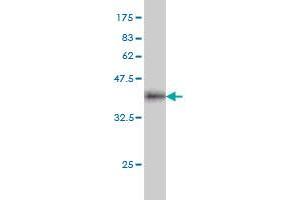 Western Blot detection against Immunogen (37. (IQGAP2 antibody  (AA 343-449))