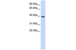 Image no. 1 for anti-Monoacylglycerol O-Acyltransferase 2 (MOGAT2) (AA 180-229) antibody (ABIN6741070) (MOGAT2 antibody  (AA 180-229))