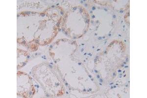 #VALUE! (SKP2 antibody  (AA 43-397))