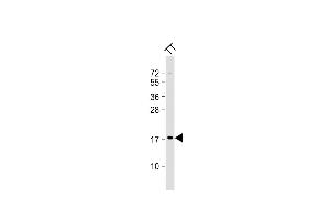 Anti-KLK7-S82 at 1:2000 dilution + TT whole cell lysate Lysates/proteins at 20 μg per lane. (Kallikrein 7 antibody  (AA 67-97))