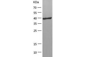 Western Blotting (WB) image for Paraneoplastic Antigen MA2 (PNMA2) (AA 2-361) protein (His-IF2DI Tag) (ABIN7124312) (PNMA2 Protein (AA 2-361) (His-IF2DI Tag))