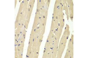 Immunohistochemistry of paraffin-embedded mouse heart using USP7 antibody at dilution of 1:200 (400x lens). (USP7 antibody)