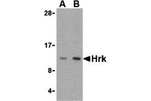 Western Blotting (WB) image for anti-Harakiri, BCL2 Interacting Protein (Contains Only BH3 Domain) (HRK) (Middle Region) antibody (ABIN1030949) (HRK antibody  (Middle Region))