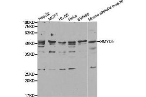 Western Blotting (WB) image for anti-SMYD Family Member 5 (SMYD5) antibody (ABIN1882323) (SMYD5 antibody)