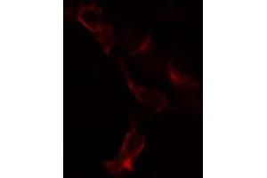 ABIN6269382 staining COLO205 cells by IF/ICC. (B-Cell Linker antibody  (N-Term))