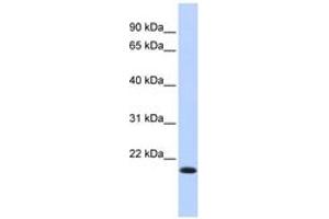 Image no. 1 for anti-Interferon Regulatory Factor 7 (IRF7) (AA 35-84) antibody (ABIN6742766) (IRF7 antibody  (AA 35-84))