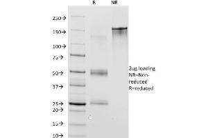 SDS-PAGE Analysis Purified MAGE-1 Mouse Monoclonal Antibody (MA454). (MAGEA1 antibody)