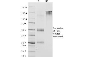 SDS-PAGE Analysis Purified MAGE-1 Mouse Monoclonal Antibody (MA454). (MAGEA1 antibody)