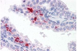 Anti-TM9SF1 antibody  ABIN960827 IHC staining of human prostate.