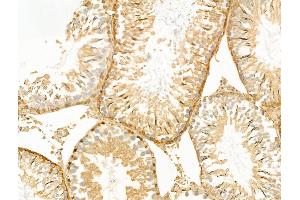 ABIN6260492 and ABIN6268884 at 1/100 staining Rat testis tissue by IHC-P.