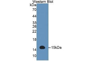 Figure. (Acyp2 antibody  (AA 2-99))