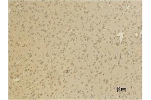 Immunohistochemistry (IHC) analysis of paraffin-embedded Rat Brain Tissue using GluR4 Polyclonal Antibody. (GRIA4 antibody)