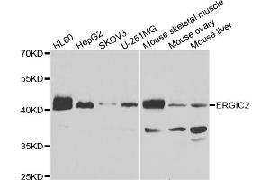 Western blot analysis of extracts of various cell lines, using ERGIC2 antibody (ABIN5975283) at 1/1000 dilution. (ERGIC2 antibody)
