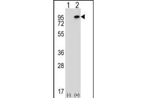 Western blot analysis of WHSC1L1 (arrow) using rabbit polyclonal WHSC1L1 Antibody (N-term) (ABIN656685 and ABIN2845923). (WHSC1L1 antibody  (N-Term))