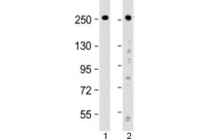 Western blot testing of human 1) HeLa and 2) SH-SY5Y cell lysate with ROBO1 antibody at 1:2000. (ROBO1 antibody  (AA 1097-1130))