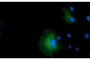 Anti-IVD mouse monoclonal antibody (ABIN2453188) immunofluorescent staining of COS7 cells transiently transfected by pCMV6-ENTRY IVD (RC201077). (IVD antibody)