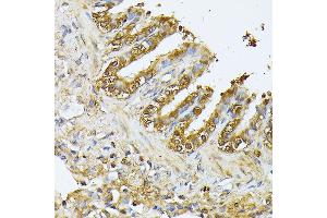 Immunohistochemistry (IHC) image for anti-Parkinson Protein 2, E3 Ubiquitin Protein Ligase (Parkin) (PARK2) (AA 1-300) antibody (ABIN3021179)