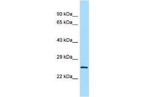 Host:  Rabbit  Target Name:  Lrrc14  Sample Type:  Mouse Testis lysates  Antibody Dilution:  1. (LRRC14 antibody  (C-Term))