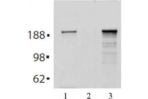 Tes2 mAb (Clone 21F11) tested by Immunoprecipitation. (TET2 antibody  (AA 1-300))
