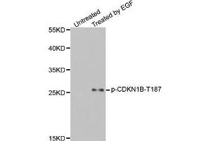 Western Blotting (WB) image for anti-Cyclin-Dependent Kinase Inhibitor 1B (p27, Kip1) (CDKN1B) (pThr187) antibody (ABIN1870060) (CDKN1B antibody  (pThr187))