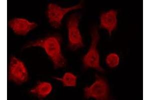 ABIN6266612 staining HeLa by IF/ICC. (p63 antibody  (C-Term))