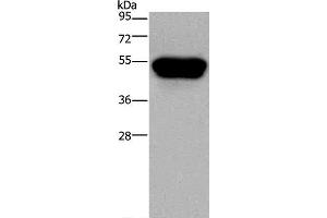 Western Blot analysis of Hela cell using CD160 Polyclonal Antibody at dilution of 1:250 (CD160 antibody)