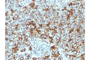 IHC testing of FFPE human pancreas with Spectrin beta III antibody (clone SPTBN2/1583). (Spectrin, Beta, Non-erythrocytic 2 (SPTBN2) (AA 356-475) antibody)